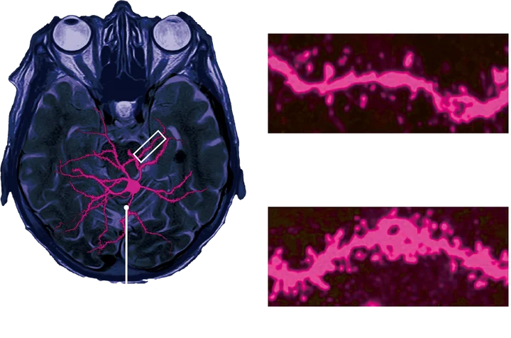 研究顯示吸食古柯鹼會改變大腦神經元的可塑性